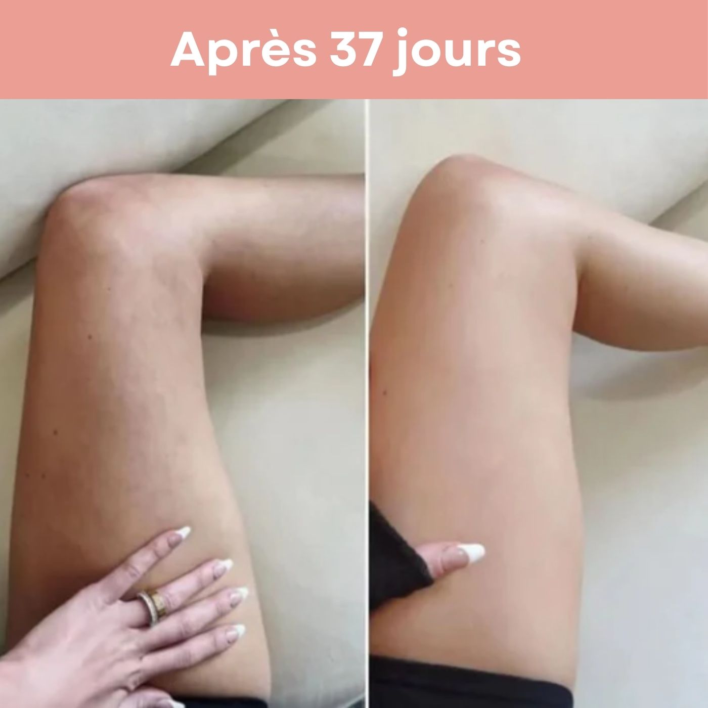Appareil de Massage Anti-Cellulite 3 en 1 - Cap-Nature