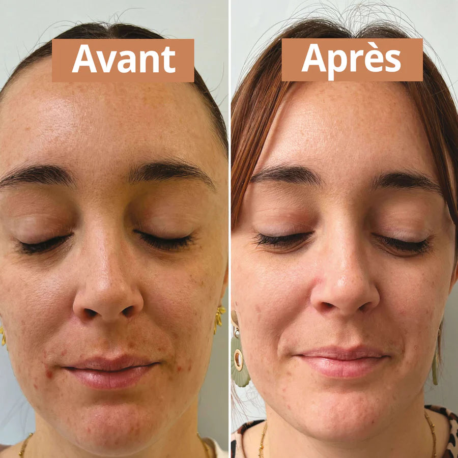 Sérum Visage Purifiant - Comme Avant - Cap-Nature